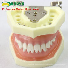 DENTAL04 (12563) Modelo de modelo anatómico Modelos de estudio dental con goma blanda